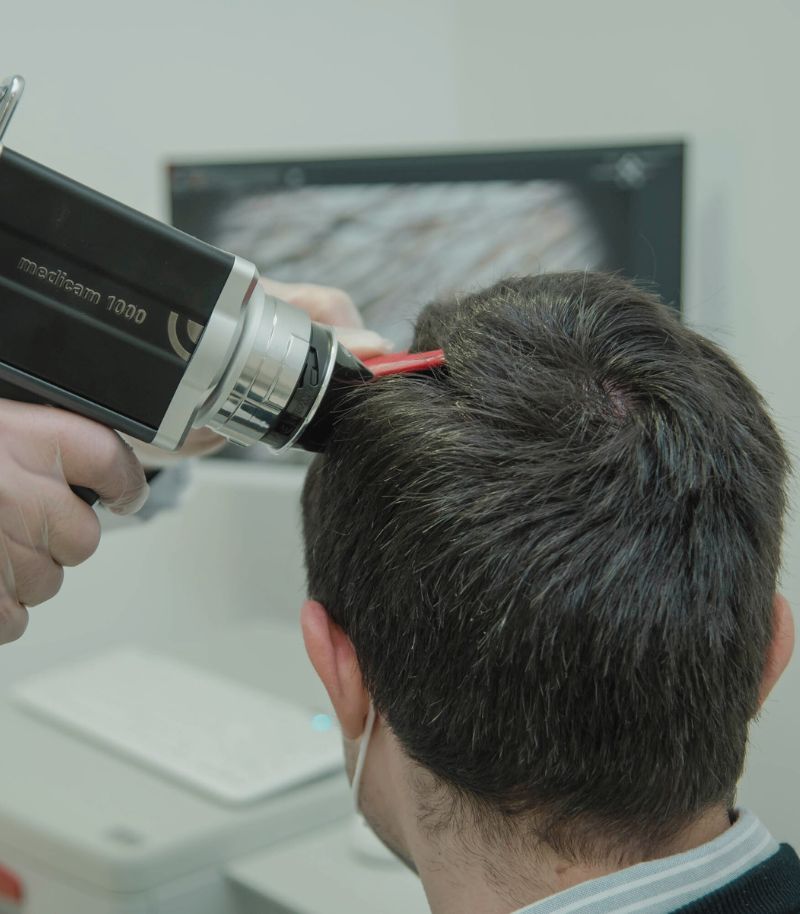 Precise Diagnosis for Hair Transplant in Specialized Clinic Precise Diagnosis for Hair Transplant in Specialized Clinic