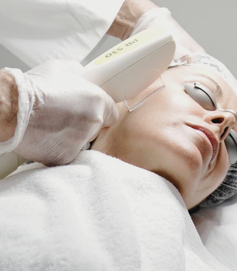 Tratamiento de rosácea con luz pulsada intensa y láser vascular de última generación